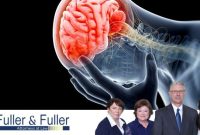 Brain injury attorneys dallas