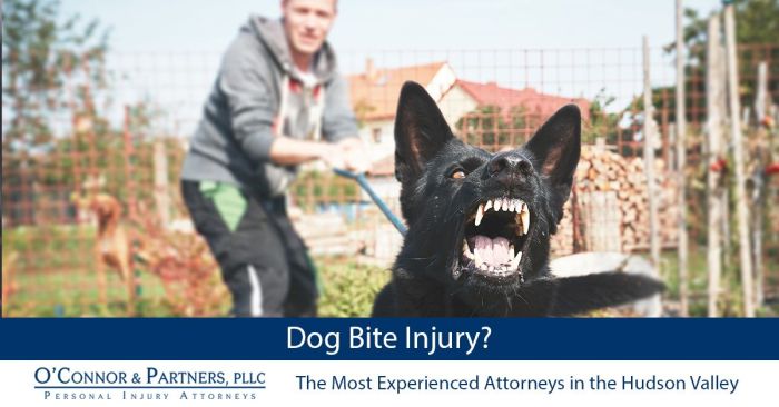 San bernardino dog bite attorneys